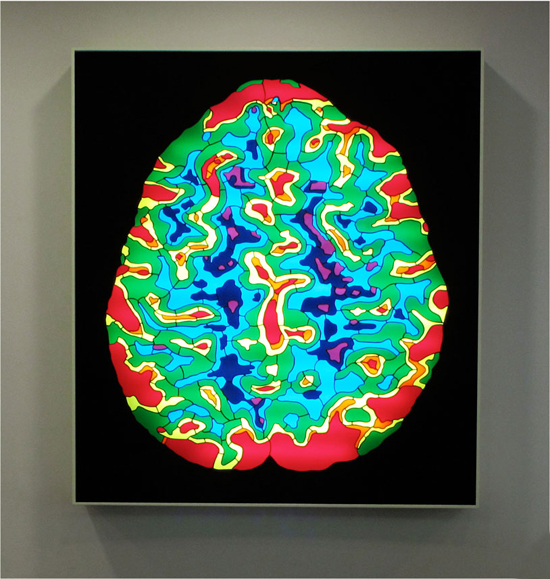 Meditating Brain, Royal Free Hospital